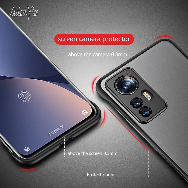 Xiaomi