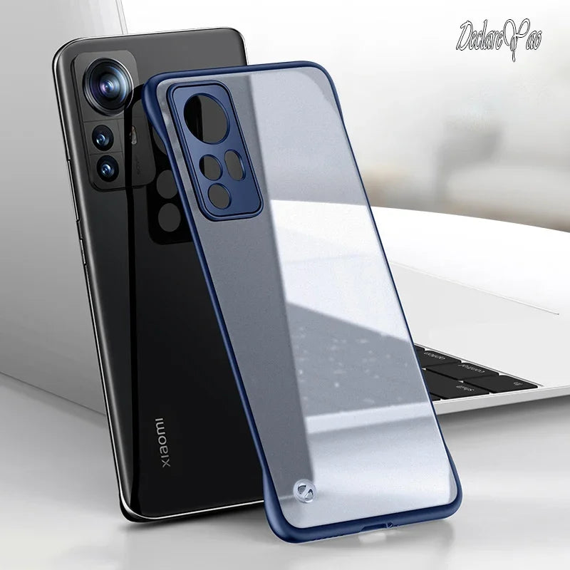 Xiaomi